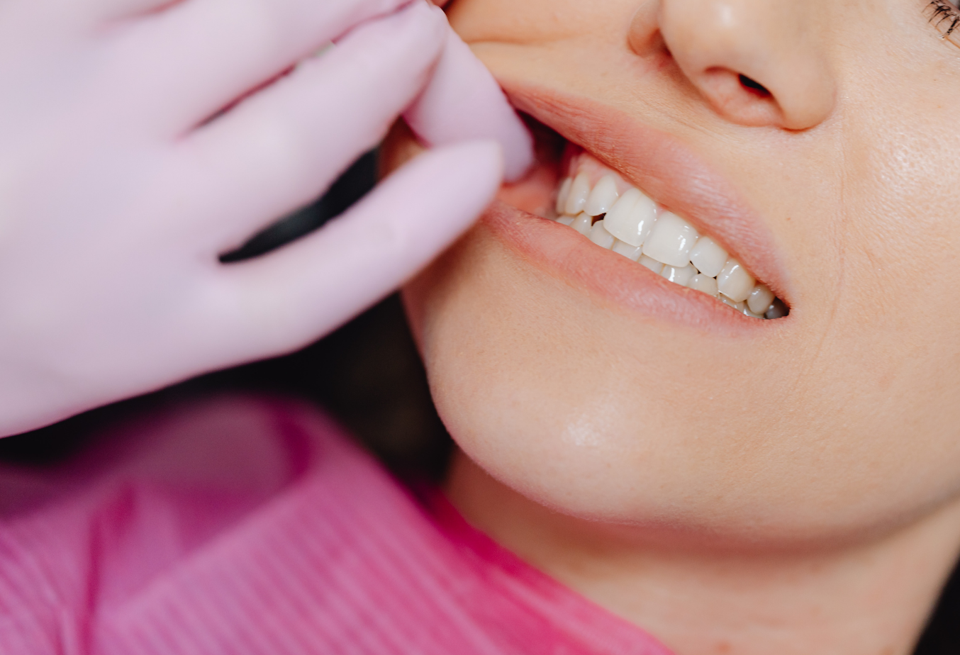 A natural-looking porcelain dental crown at Chapeltown Dental Care, Sheffield