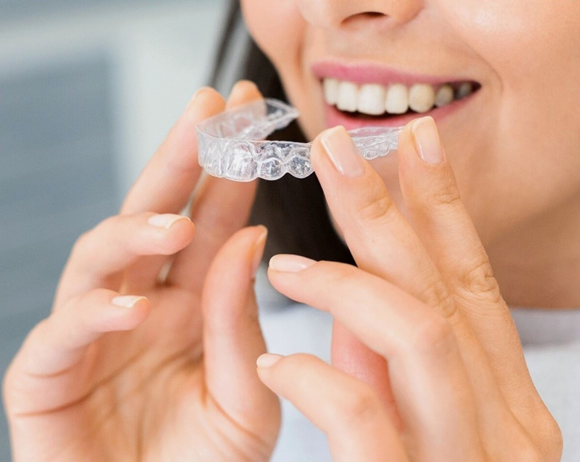 Discreet Invisalign clear aligners at Chapeltown Dental Care, Sheffield